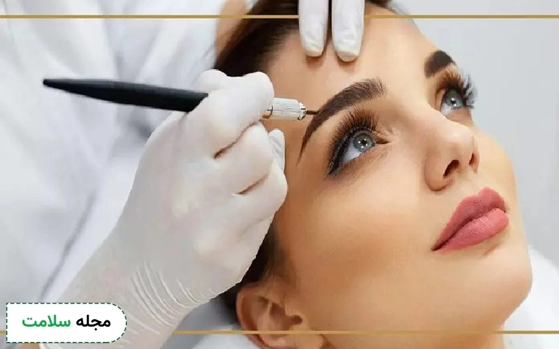 کاشت ابرو چگونه انجام می‌شود؟ مزایا و عوارض این روش چیست؟