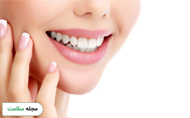 بلیچینگ دندان برای چه کسانی مناسب است؟