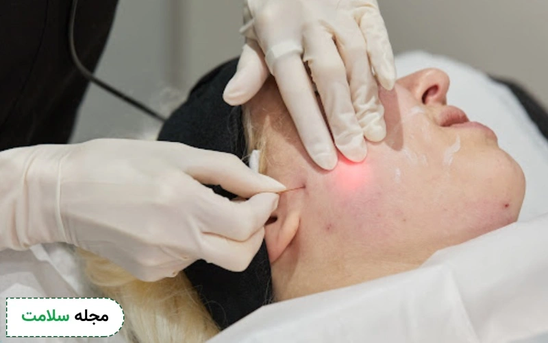 لیفت با اندولیفت چگونه اتس؟