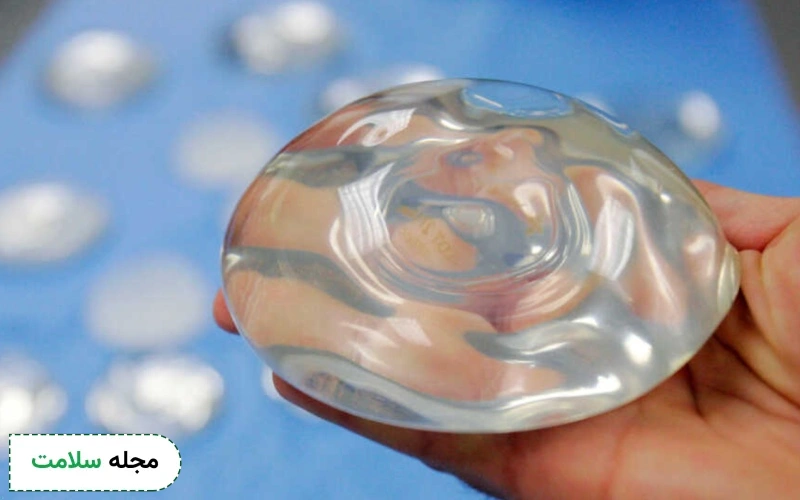 پروتز سینه سیلیکونی؛ مزایا و نکات مهم قبل از عمل جراحی