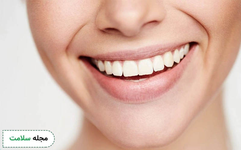 انواع کامپوزیت دندان، مزایا و معایب آن را بشناسید