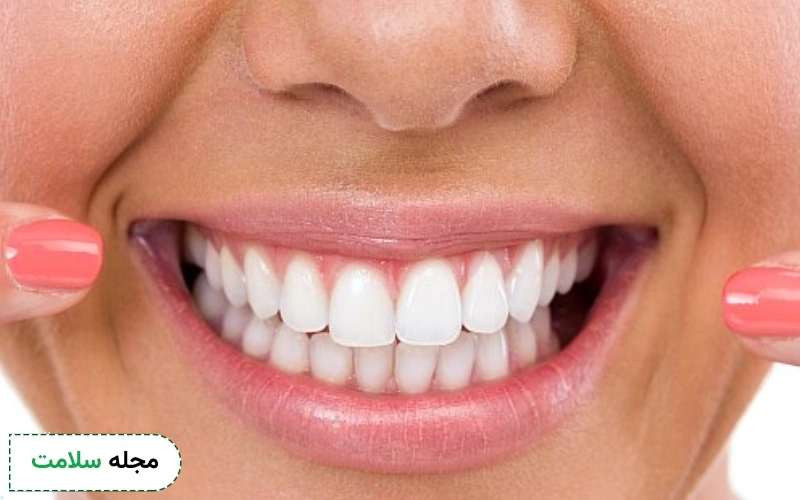 عوارض بلیچینگ دندان