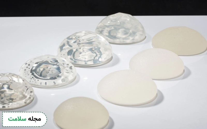 مزایای پروتز سینه ثابت