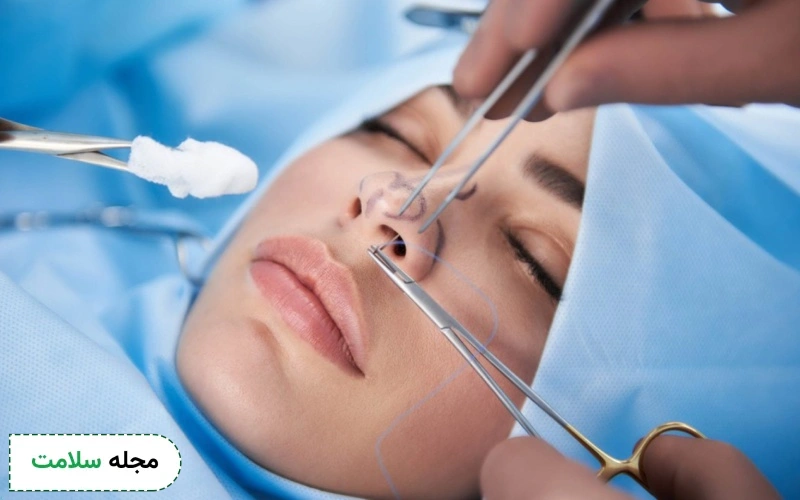 انواع رینوپلاستی کدامند؟