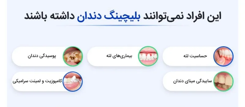 اینفوگرافی بلیجینگ دندان