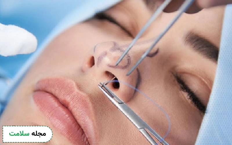 درد پس از جراحی زیبایی بینی طبیعی است.