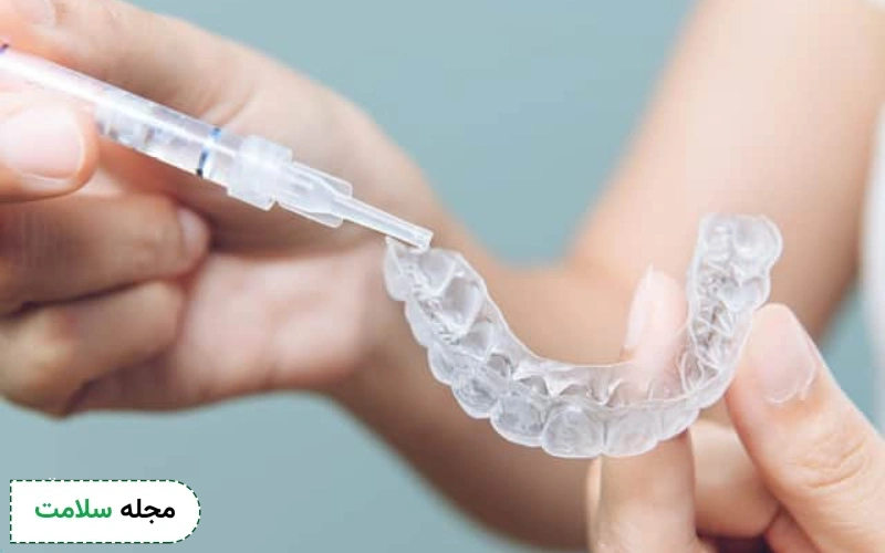 بلیچینگ دندان در خانه