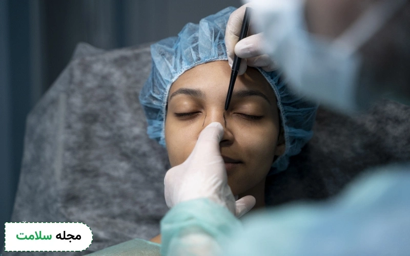 دندانپزشکی بعد از عمل بینی