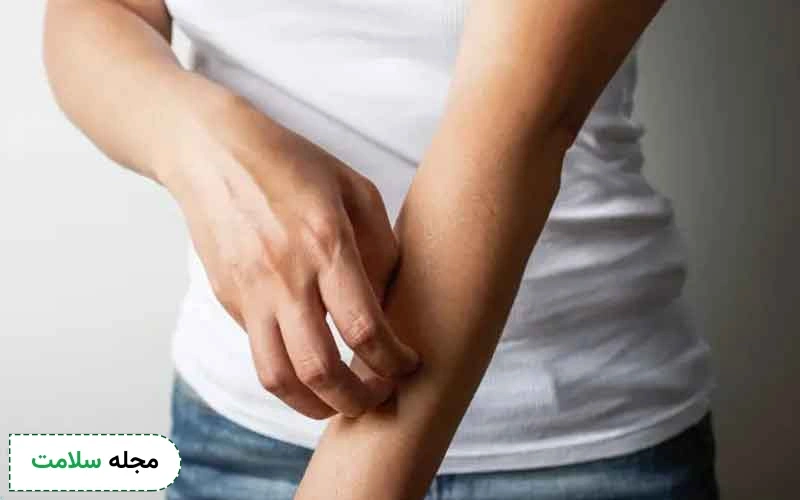 کدام پماد برای راش پوستی موثرتر است؟