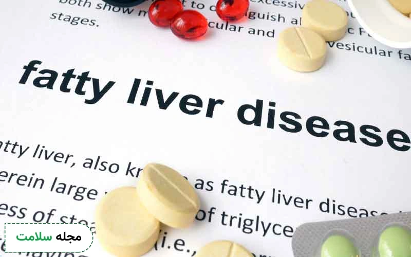 قرص و دارو برای کبد چرب