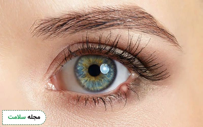 آشنایی با بهترین پماد چشمی برای گل مژه