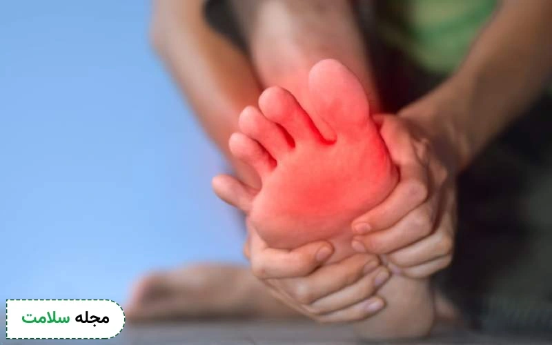 قرص برای سوزش کف پا چیست؟