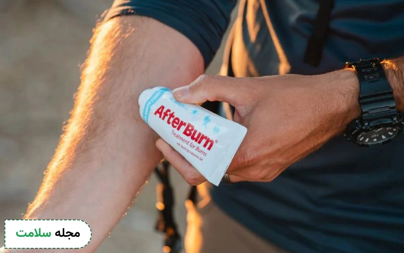 معرفی بهترین پمادهای سوختگی