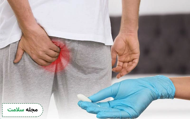 آشنایی با نحوه انتخاب بهترین قرص برای درمان بواسیر