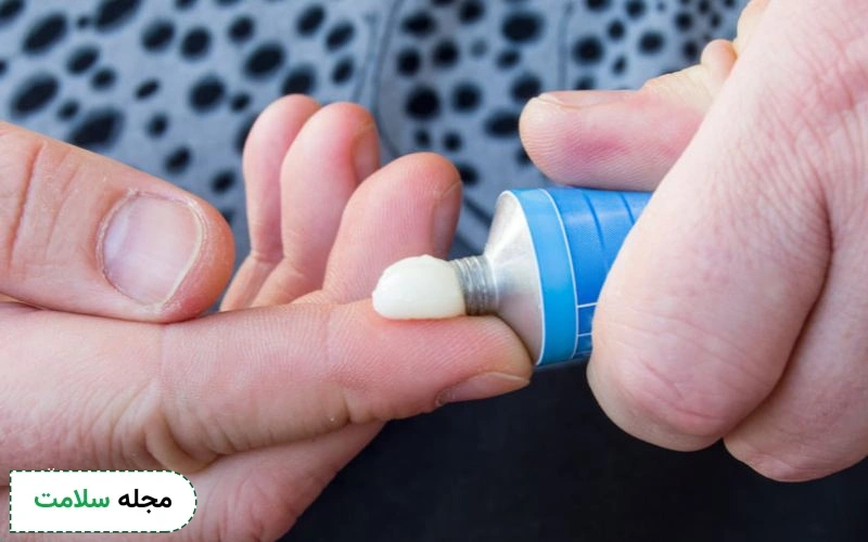 بهترین پماد برای درمان زخم پای دیابتی کدام است؟