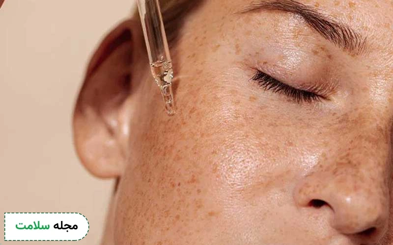 بررسی فهرست قویترین داروی ضد لک صورت