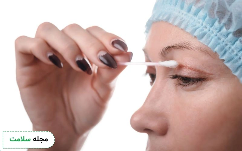 مزایای استفاده از کرم ترمیم کننده بعد از بلفاروپلاستی چیست؟