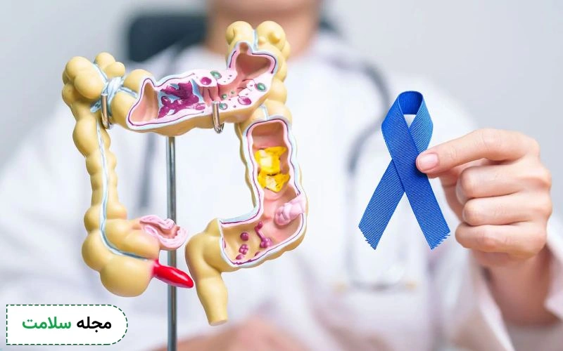 بهترین قرص سرطان روده بزرگ چه نام دارد؟