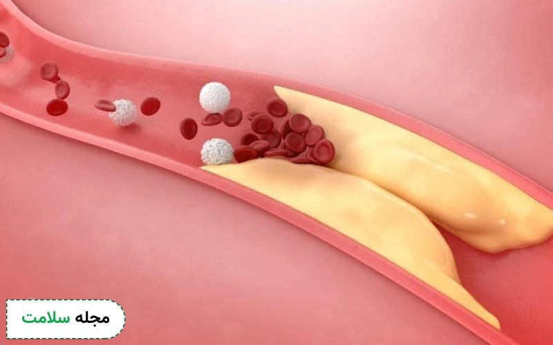 قرص آنتوم برای چی خوبه؟