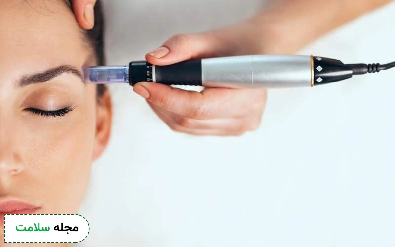 موارد احتیاط و منع مصرف پماد زینک اکساید بعد از میکرونیدلینگ چیست؟