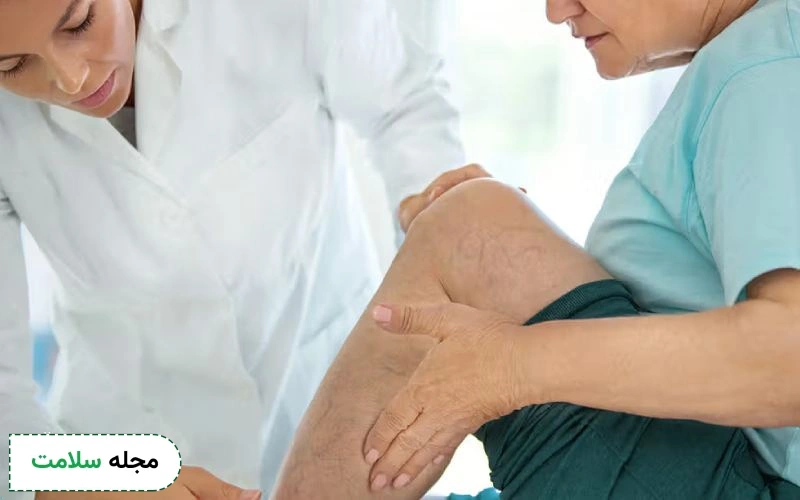 قرص دافلون برای واریس مناسب است؟