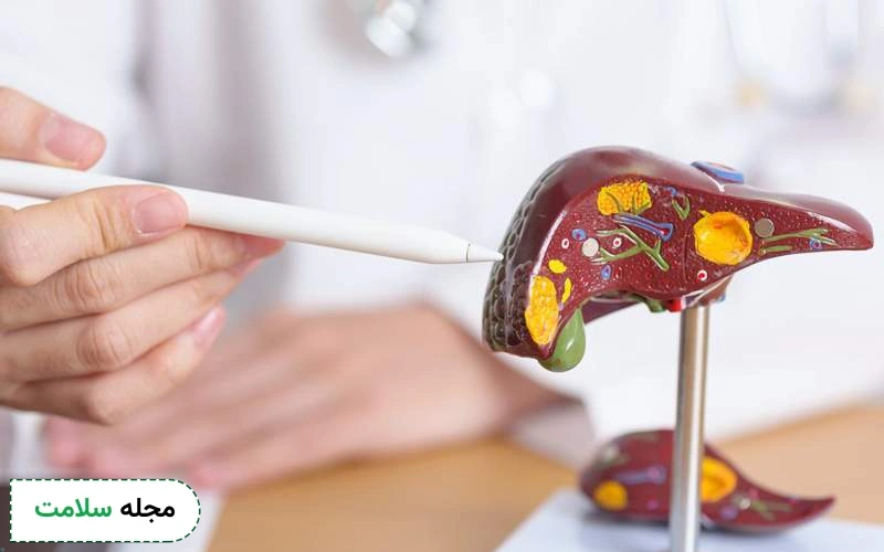 تاثیر قرص گلوتازون روی کبد چرب چقدر است؟