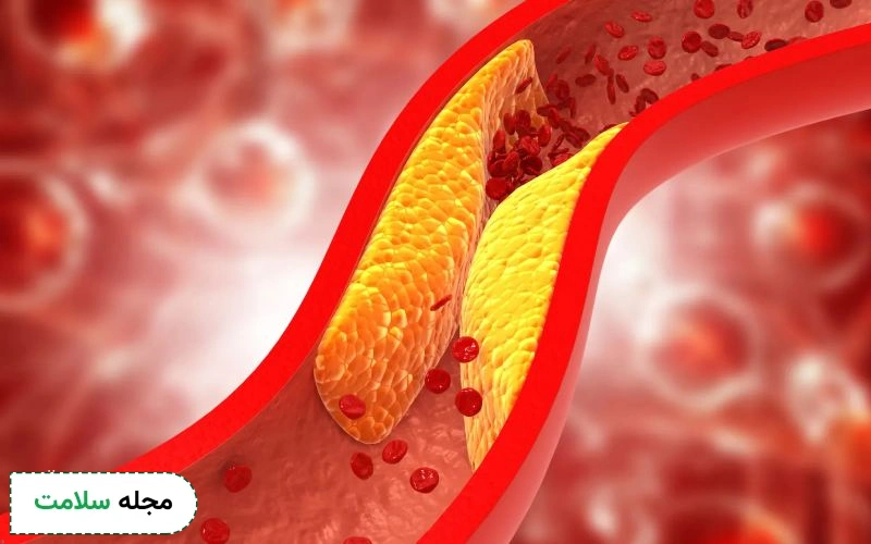 قرص روپیکسون برای چی خوبه؟