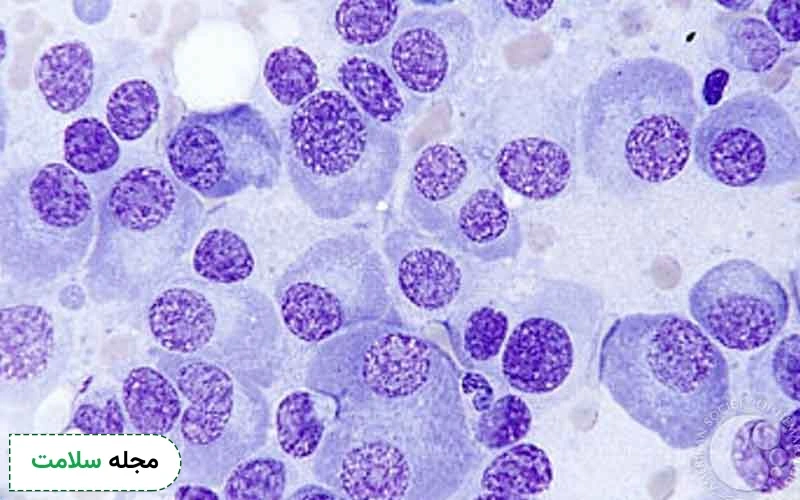 ونتوکلکس یکی از داروهای موثر در درمان سرطان مغز استخوان است.