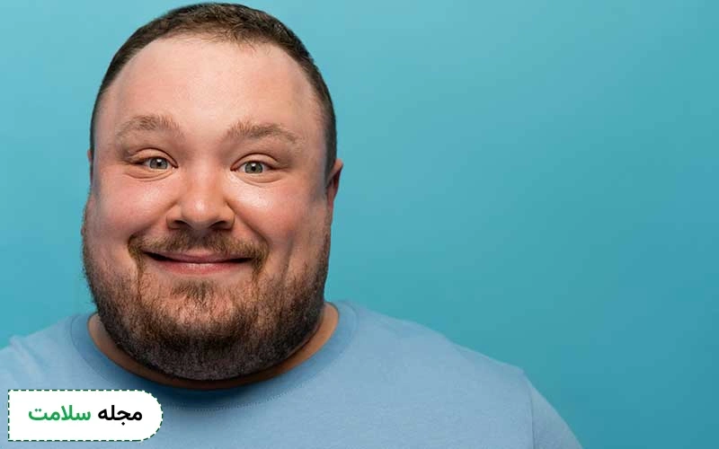 قرص پردنیزولون و چاقی صورت چه ارتباطی با هم دارند؟