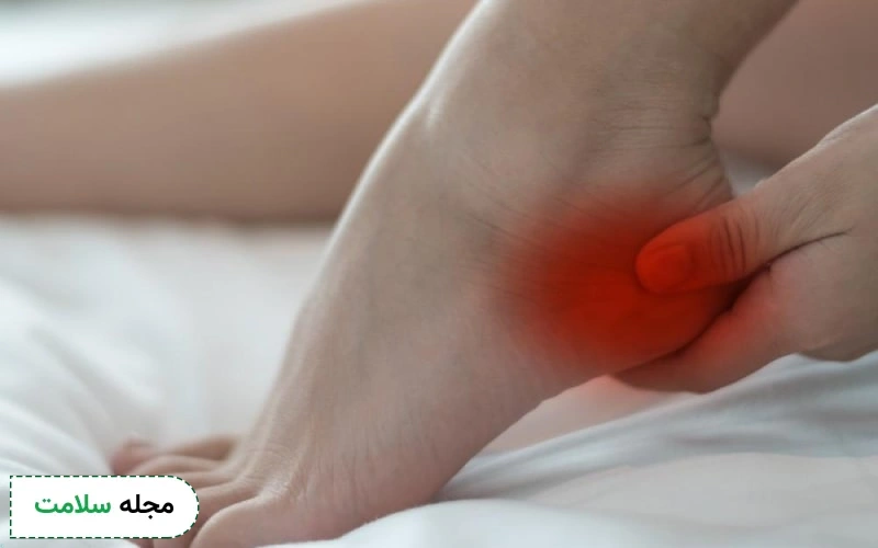 راهنمای انتخاب بهترین کرم خار پاشنه برای کاهش درد ناشی از آن