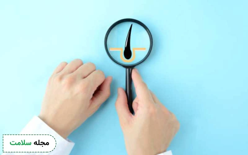 قرص رویال کلاژن ایکس مارت برای چی خوبه؟