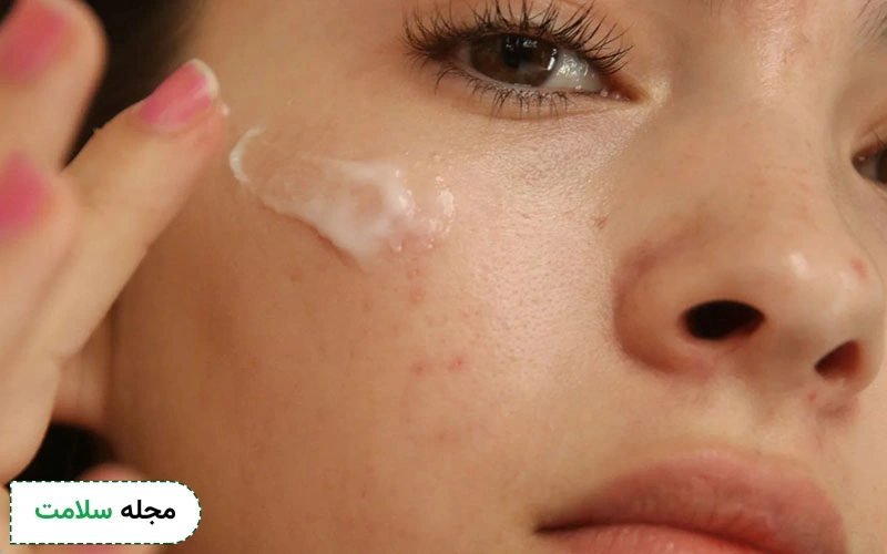 نحوه مصرف آزلائیک اسید چگونه است؟