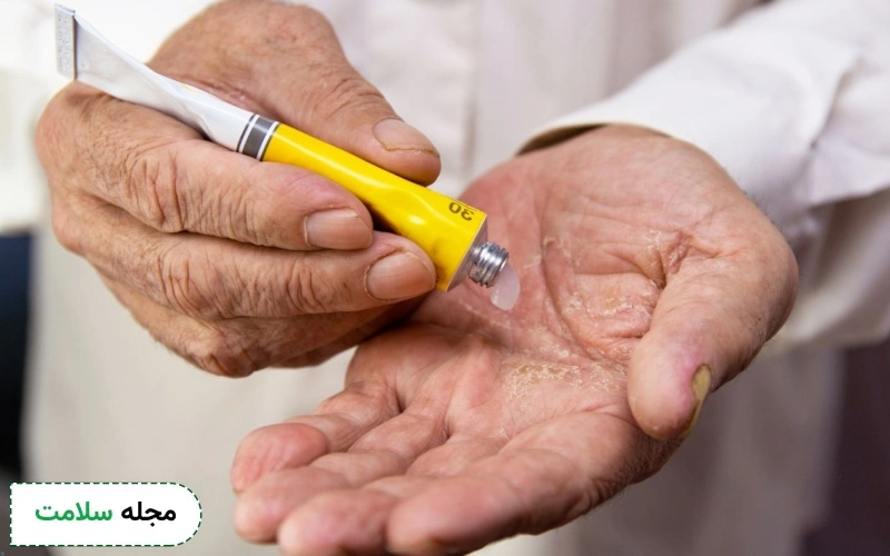 کرم ضد اگزما تاکریل