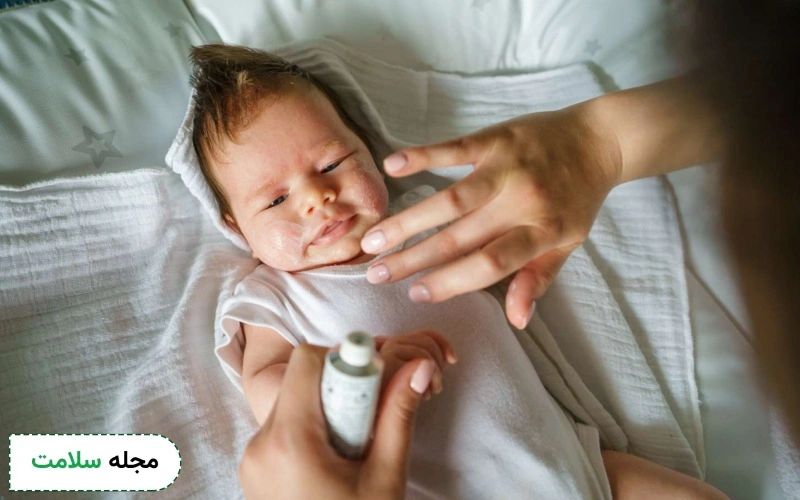 داروی ضد اگزما برای نوزادان