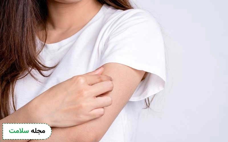 داروی آنتی هیستامین برای خارش بدن