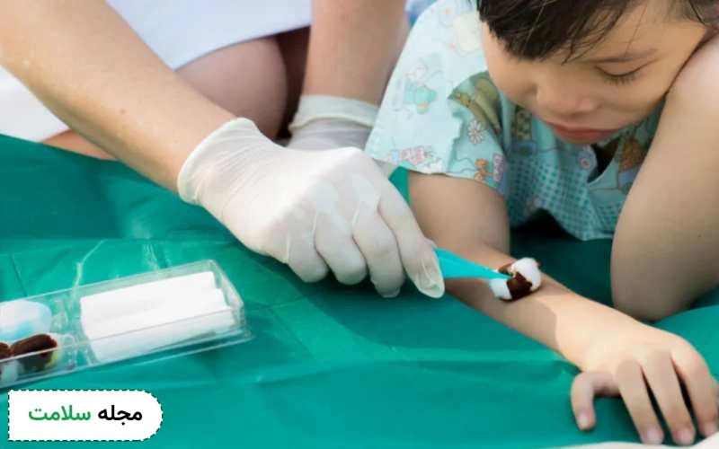 عوارض جانبی بتادین خیلی کم است.