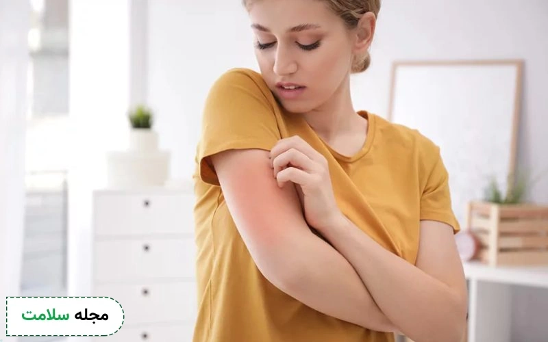 موارد احتیاط و منع مصرف پماد کلوبتازول