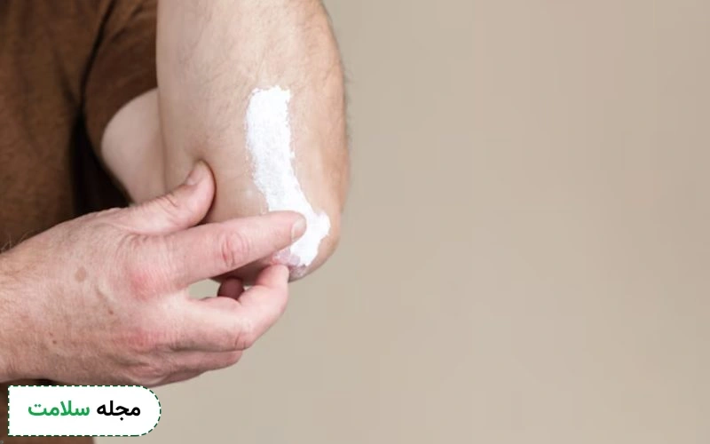 پماد آلفا برای جای بخیه خوب است؟