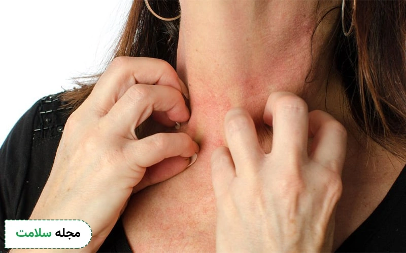 تداخل دارویی دس لوراتادین ممکن است باعث خارش شود.