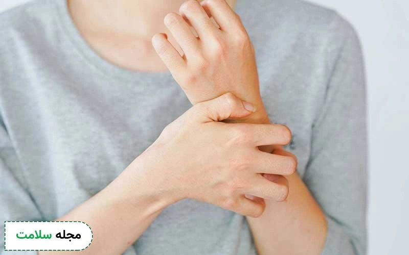 راهنمای انتخاب بهترین دارو برای خارش بدن؛ انواع داروهای شیمیایی و گیاهی