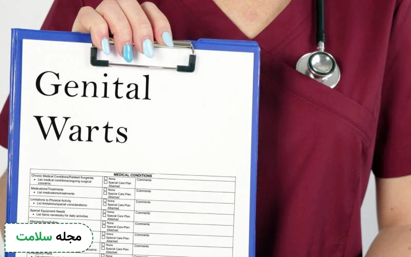 بهترین پماد برای زگیل تناسلی زنان چیست؟