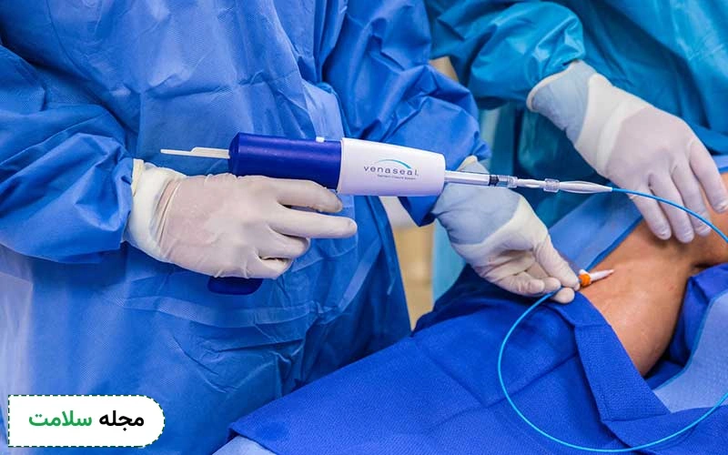 چسب واریس چیست و چه کاربردی دارد؟