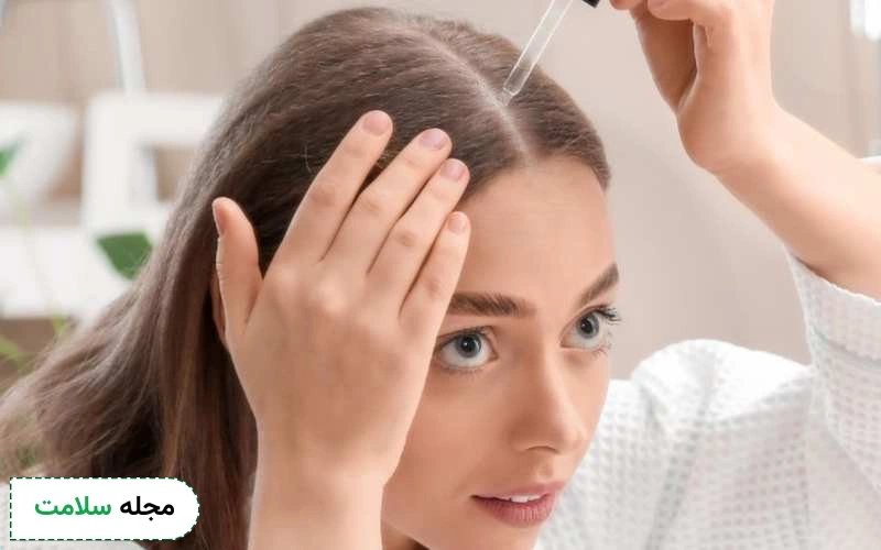 ماینوکسیدیل چیست؟