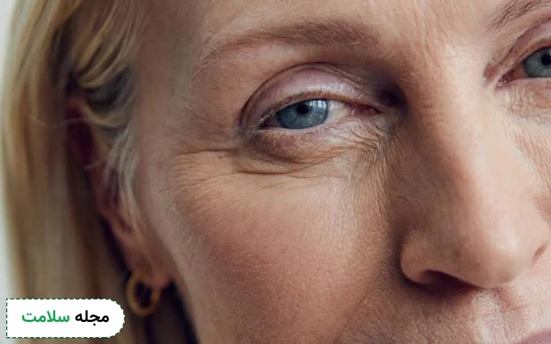 قرص پیگمنتا چاق کننده است؟