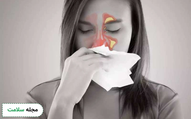 قرص تاوانکس برای سینوزیت هم استفاده میشود.