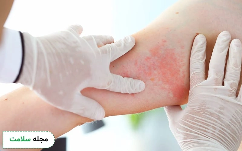 دوز مصرفی دس لوراتادین را پزشک مشخص می کند.