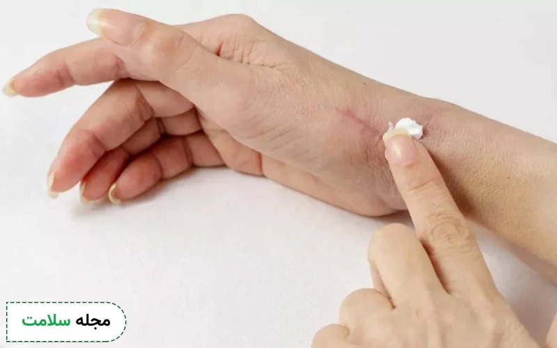 جنتامایسین 100 برای درمان عفونت پوست استفاده می شود.