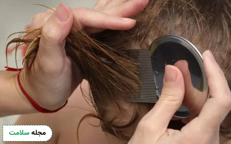 عوارض داروی لیندان چیست؟