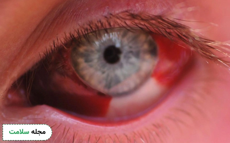 عوارض قرص b۱۲ چیست؟