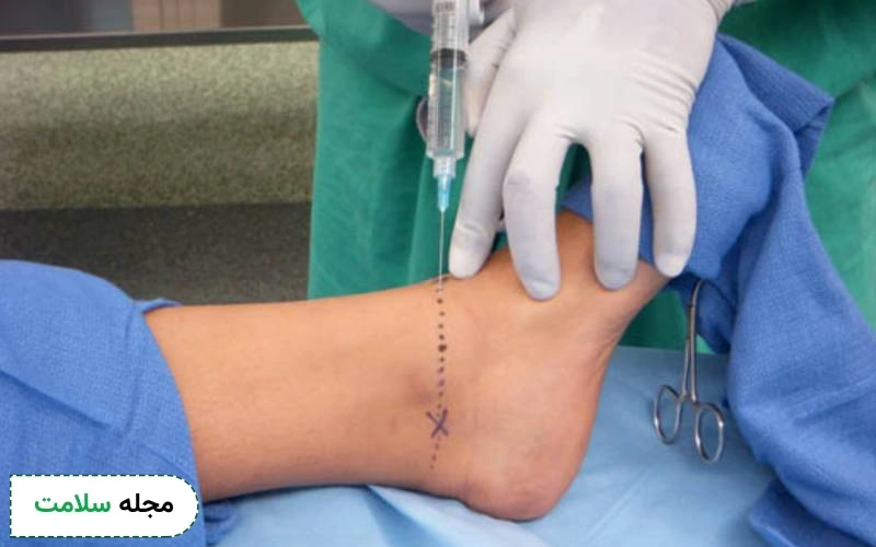 آمپول و قرص برای بی حسی پا چیست؟